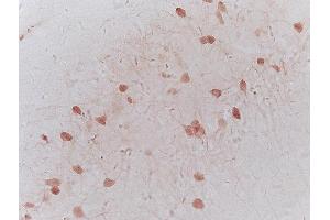 Immunohistochemistry (IHC) image for anti-RE1-Silencing Transcription Factor (REST) (AA 401-450) antibody (ABIN747683)