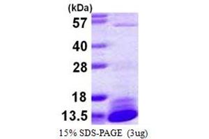 SDS-PAGE (SDS) image for Dynein, Light Chain, LC8-Type 2 (DYNLL2) (AA 1-89) protein (His tag) (ABIN667470) (DYNLL2 Protein (AA 1-89) (His tag))