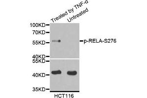 Western blot analysis of extracts of various cell lines, using Phospho-RELA-S276 antibody. (NF-kB p65 Antikörper  (pSer276))