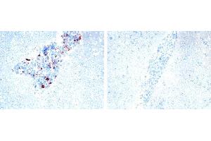 Image no. 1 for anti-Tumor Necrosis Factor (Ligand) Superfamily, Member 13 (TNFSF13) antibody (ABIN187283) (TNFSF13 Antikörper)