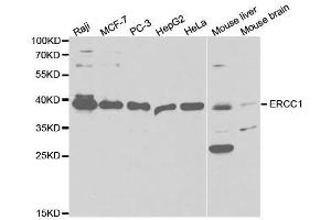 Western blot analysis of extracts of various cell lines, using ERCC1 antibody. (ERCC1 Antikörper  (AA 1-323))