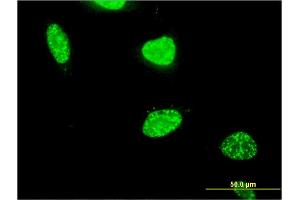 Immunofluorescence of monoclonal antibody to PAXIP1 on HeLa cell.