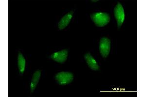Immunofluorescence of purified MaxPab antibody to TTK on HeLa cell. (Mps1 Antikörper  (AA 1-857))