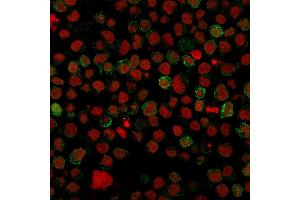 Immunofluorescence (IF) image for anti-CD22 Molecule (CD22) (AA 52-178) antibody (ABIN6941121)