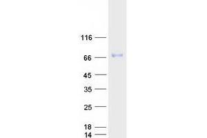 Western Blotting (WB) image for serine Peptidase Inhibitor, Kunitz Type 1 (SPINT1) (Transcript Variant 1) protein (Myc-DYKDDDDK Tag) (ABIN2732600)