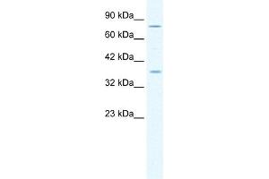 MCM4 antibody used at 1. (MCM4 Antikörper  (Middle Region))