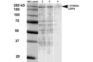 Western Blot analysis of Rat brain membrane lysate showing detection of LRP4 protein using Mouse Anti-LRP4 Monoclonal Antibody, Clone S207-27 . (LRP4 Antikörper  (AA 26-350) (APC))