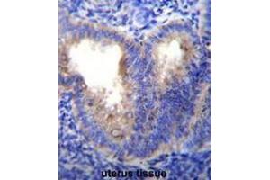 Immunohistochemistry (Paraffin-embedded Sections) (IHC (p)) image for anti-Eukaryotic Translation Initiation Factor 5A-Like 1 (EIF5AL1) (AA 101-130), (C-Term) antibody (ABIN952055)