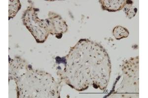 Image no. 1 for anti-Zic Family Member 4 (ZIC4) (AA 249-320) antibody (ABIN466251) (ZIC4 Antikörper  (AA 249-320))