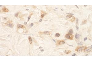 Immunohistochemistry (IHC) image for anti-serine threonine Kinase 39 (STK39) (AA 425-450) antibody (ABIN7448809)