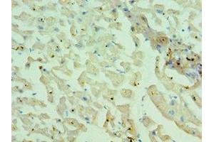 Immunohistochemistry of paraffin-embedded human heart tissue using ABIN7160559 at dilution of 1:100 (MYH1 Antikörper  (AA 1-100))
