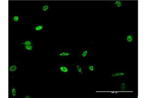 Immunofluorescence of monoclonal antibody to HES2 on HeLa cell. (HES2 Antikörper  (AA 41-114))