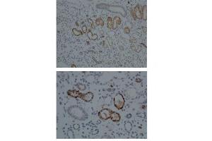 Immunohistochemistry (IHC) image for anti-Cytochrome P450, Family 1, Subfamily A, Polypeptide 1 (CYP1A1) (Middle Region) antibody (ABIN2776792)