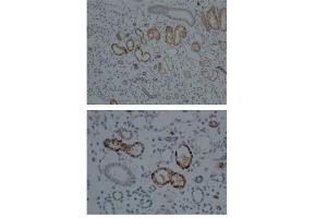 Sample Type:  Human Kidney   Dilution:  1:100 (CYP1A1 Antikörper  (Middle Region))