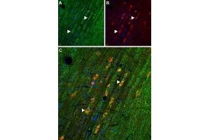 Expression of Adenosine A1 Receptor in rat medial septumImmunohistochemical staining of rat medial septum frozen section using Anti-Adenosine A1 Receptor Antibody (ABIN7042882, ABIN7043894 and ABIN7043895). (Adenosine A1 Receptor (ADORA1) Peptid)