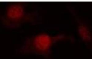 Immunofluorescent analysis of PTEN (pS380/T382/T383) staining in Hela cells. (PTEN Antikörper  (C-Term, pSer380, pThr382, pThr383))