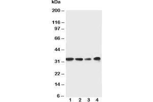 Western blot testing of MyD88 antibody and Lane 1:  rat spleen;  2: rat thymus;  3: Jurkat;  4: Raji cell lysate. (MYD88 Antikörper  (Middle Region))