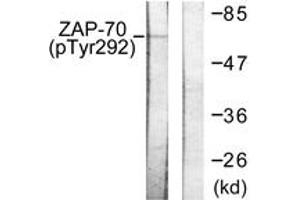 Western blot analysis of extracts from Jurkat cells treated with UV 15', using ZAP-70 (Phospho-Tyr292) Antibody. (ZAP70 Antikörper  (pTyr292))