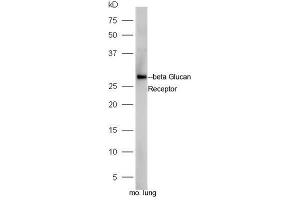 Mouse lung lysates probed with Rabbit Anti-Beta Glucan Receptor Polyclonal Antibody, Unconjugated  at 1:5000 for 90 min at 37˚C. (CLEC7A Antikörper  (AA 41-140))