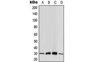 Western blot analysis of CABP4 expression in HeLa (A), HepG2 (B), SP2/0 (C), PC12 (D) whole cell lysates.