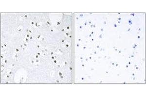 Immunohistochemistry analysis of paraffin-embedded human brain tissue, using c-Jun (Ab-243) Antibody. (C-JUN Antikörper  (AA 210-259))