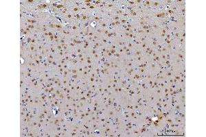 IHC analysis of CEP250 using anti-CEP250 antibody (ABIN7602053). (CEP250 Antikörper  (AA 563-853))