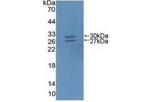 Figure. (ABCG5 Antikörper  (AA 66-276))