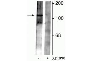 Western blot of rat synaptic membrane lysate showing specific immunolabeling of the ~102 kDa GABAB R2 protein phosphorylated at Ser783 in the first lane (-).