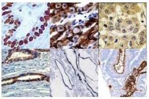 Immunohistochemistry Protein Blocker is the best first choice for blocking paraffin fixed or frozen sectioned tissues specimens for immunohistochemical staining for immunoenzymatic signal processing. (Meerschweinchen Liver Acetone Tissue Powder)