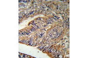 Immunohistochemistry (Paraffin-embedded Sections) (IHC (p)) image for anti-Interleukin 1 Receptor Antagonist (IL1RN) (AA 100-129) antibody (ABIN390396)