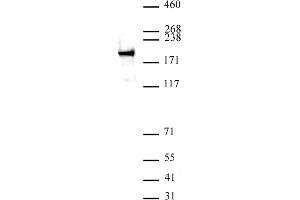 ZEB1 antibody (pAb) tested by Western blot.