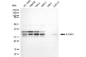 Western blotting analysis using EIF4E2 antibody (ABIN7798533). (EIF4E2 Antikörper)