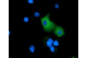 Anti-ARHGAP25 mouse monoclonal antibody (ABIN2452774) immunofluorescent staining of COS7 cells transiently transfected by pCMV6-ENTRY ARHGAP25 (RC217414). (ARHGAP25 Antikörper)