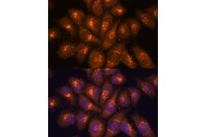 Immunofluorescence analysis of HeLa cells using B3GNT4 antibody (ABIN7265875) at dilution of 1:100. (B3GNT4 Antikörper  (AA 165-305))