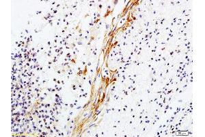 Formalin-fixed and paraffin-embedded rat skin tissue labeled with Anti-Collagen V Polyclonal Antibody, Unconjugated  1:200 followed by conjugation to the secondary antibody and DAB staining (Collagen Type V Antikörper  (AA 1450-1500))