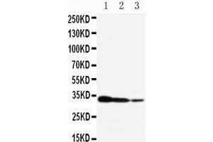 Western Blotting (WB) image for anti-CREB Regulated Transcription Coactivator 2 (CRTC2) (AA 595-611), (C-Term) antibody (ABIN3042964) (CRTC2 Antikörper  (C-Term))