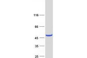 Western Blotting (WB) image for Tropomodulin 2 (TMOD2) (Transcript Variant 1) protein (Myc-DYKDDDDK Tag) (ABIN2734378)