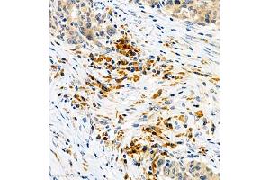 Immunohistochemistry (Paraffin-embedded Sections) (IHC (p)) image for anti-Colony Stimulating Factor 1 (Macrophage) (CSF1) antibody (ABIN7073553)