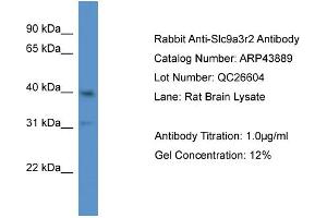 Western Blotting (WB) image for anti-Solute Carrier Family 9 (Sodium/hydrogen Exchanger), Member 3 Regulator 2 (SLC9A3R2) (N-Term) antibody (ABIN2781612) (SLC9A3R2 Antikörper  (N-Term))