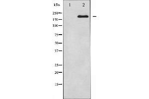 Western blot analysis of BRCA1 expression in whole cell lysates,The lane on the left is treated with the antigen-specific peptide. (BRCA1 Antikörper  (Internal Region))