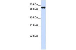 Western Blot showing ZFYVE1 antibody used at a concentration of 1-2 ug/ml to detect its target protein. (ZFYVE1 Antikörper  (C-Term))