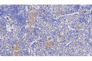 Immunohistochemistry (IHC) image for anti-Diazepam Binding Inhibitor (DBI) (AA 2-87) antibody (ABIN7435565)