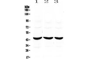 Western blot analysis of ADA using anti-ADA antibody .