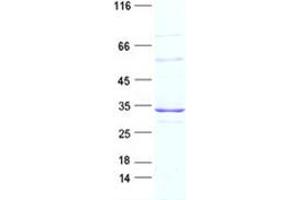 Western Blotting (WB) image for ATP-Binding Cassette, Sub-Family B (MDR/TAP), Member 1 (ABCB1) protein (DYKDDDDK Tag) (ABIN2713531)