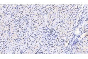 Detection of PDGFC in Human Kidney Tissue using Polyclonal Antibody to Platelet Derived Growth Factor C (PDGFC) (PDGFC Antikörper  (AA 235-345))