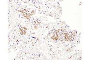 Immunohistochemistry (IHC) image for anti-Cyclin-Dependent Kinase 5, Regulatory Subunit 1 (p35) (CDK5R1) (AA 110-160) antibody (ABIN7453924)