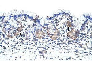UPF3B antibody was used for immunohistochemistry at a concentration of 4-8 ug/ml to stain EpitheliaI cells of fundic gland (arrows) in Human Stomach. (UPF3B Antikörper)
