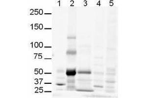 Image no. 1 for anti-GLI Family Zinc Finger 3 (GLI3) (AA 41-57) antibody (ABIN401281) (GLI3 Antikörper  (AA 41-57))