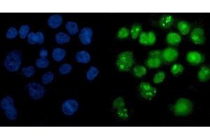 IF analysis of PARP using anti-PARP antibody (ABIN7602277). (PARP1 Antikörper  (AA 670-858))