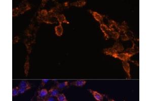 Immunofluorescence analysis of HeLa cells using POR Polyclonal Antibody at dilution of 1:100 (40x lens). (POR Antikörper)